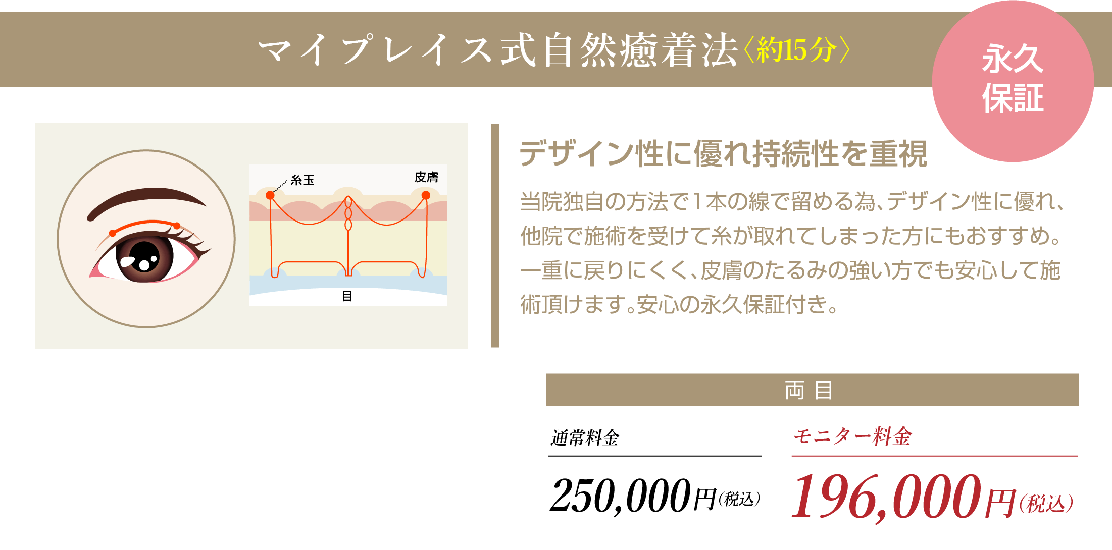 マイプレイス式自然癒着法