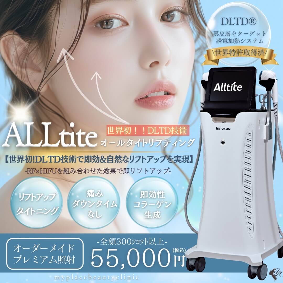 オールタイトリフティング