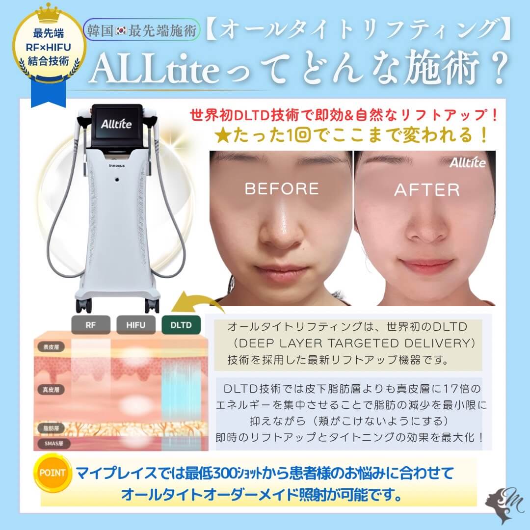世界初DLTD技術で即効＆自然なリフトアップ